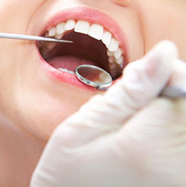 Thirroul Dental Studio Dentist North Wollongong Dentist 0306 Teeth Cleaning Thumb